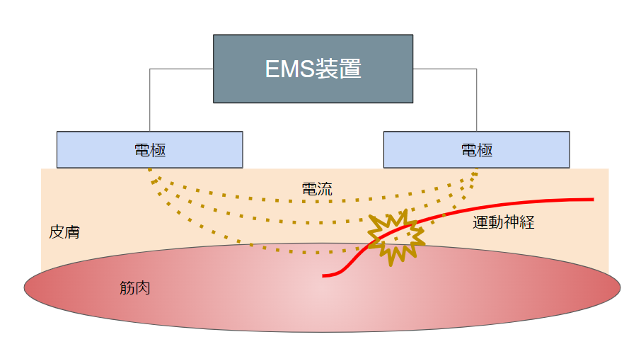 EMSの仕組み